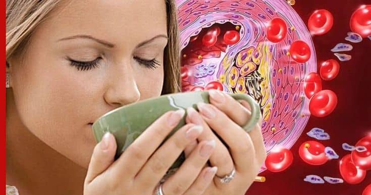 kava-pri-pidvishhenomu-holesterini-korist-chi-shkoda